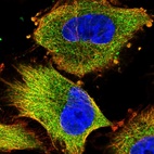 Immunofluorescent staining of human cell line U-251 MG shows localization to cytosol.