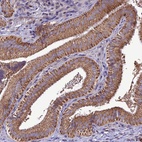 Anti-MAP3K12 Antibody