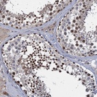 Anti-CCDC184 Antibody