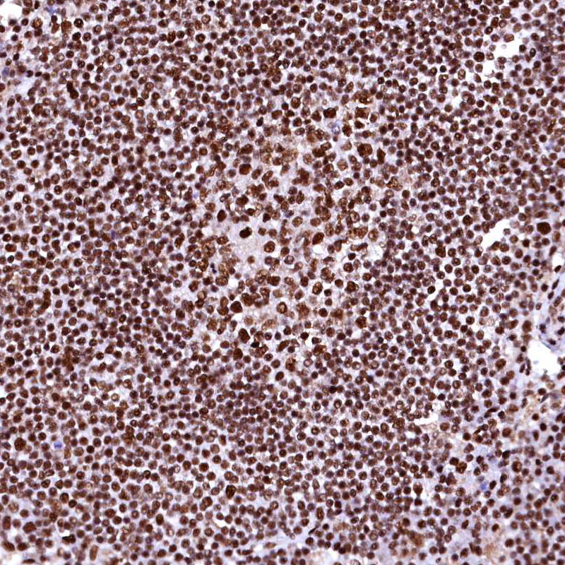 Anti-CPSF6 Antibody