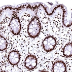 Immunohistochemical staining of human colon shows strong nuclear positivity in glandular cells.
