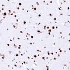 Immunohistochemical staining of human cerebral cortex shows strong nuclear positivity in neurons.