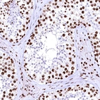 Immunohistochemical staining of human testis shows strong nuclear positivity in cells in seminiferous ducts.