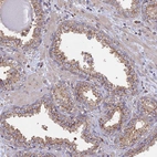 Immunohistochemical staining of human prostate shows moderate granular cytoplasmic positivity in glandular cells.