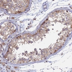 Immunohistochemical staining of human testis shows moderate to strong granular cytoplasmic positivity in cells in seminiferous ducts.