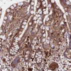 Immunohistochemical staining of human colon shows strong cytoplasmic positivity in lymphoid cells.