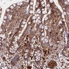 Immunohistochemical staining of human colon shows strong cytoplasmic positivity in lymphoid cells.