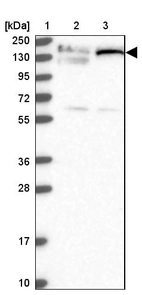 Lane 1: Marker [kDa] 250, 130, 95, 72, 55, 36, 28, 17, 10_br/_Lane 2: Human cell line RT-4_br/_Lane 3: Human cell line U-251MG sp