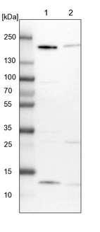 Lane 1: NIH-3T3 cell lysate (Mouse embryonic fibroblast cells)_br/_Lane 2: NBT-II cell lysate (Rat Wistar bladder tumour cells)