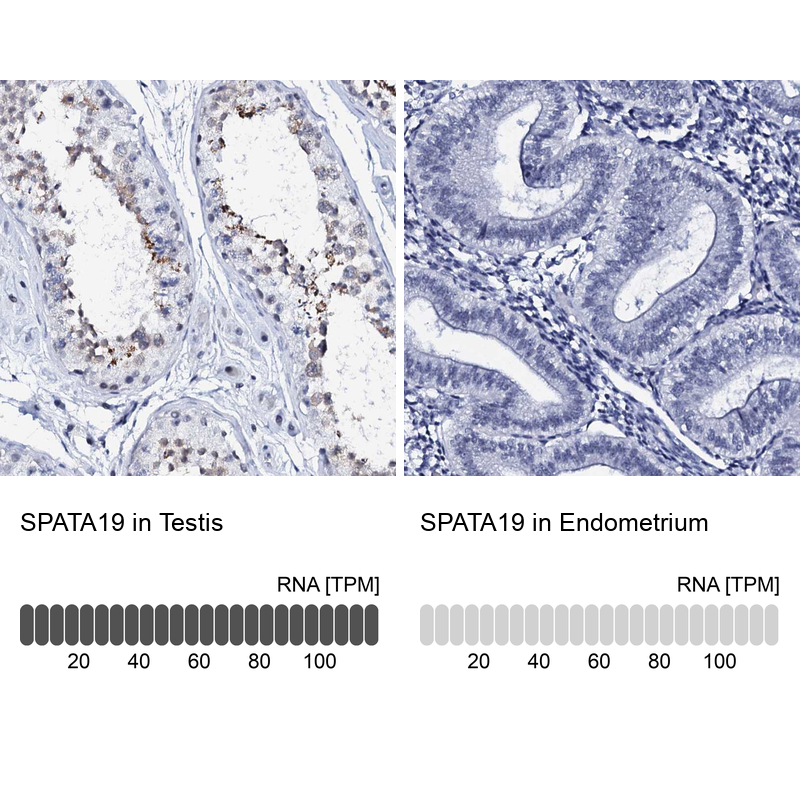 Anti-SPATA19 Antibody