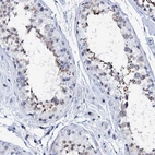 Immunohistochemical staining of human testis shows high expression.