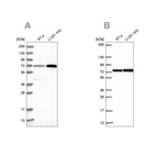 Anti-PES1 Antibody