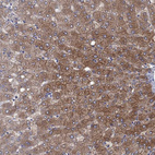 Immunohistochemical staining of human liver shows strong cytoplasmic positivity in hepatocytes.
