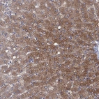 Immunohistochemical staining of human liver shows strong cytoplasmic positivity in hepatocytes.