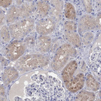 Immunohistochemical staining of human kidney shows moderate cytoplasmic positivity in cells in tubules.