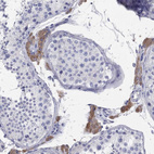 Immunohistochemical staining of human testis shows strong cytoplasmic positivity in Leydig cells.