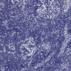 Immunohistochemical staining of human lymph node shows no cytoplasmic positivity in non-germinal center cells as expected.