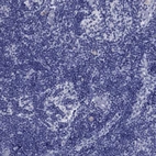 Immunohistochemical staining of human lymph node shows no cytoplasmic positivity in non-germinal center cells as expected.