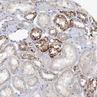 Immunohistochemical staining of human kidney shows strong granular cytoplasmic positivity in subset of cells in tubules.