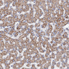 Immunohistochemical staining of human liver shows moderate granular cytoplasmic positivity in hepatocytes.