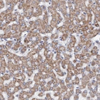 Immunohistochemical staining of human liver shows moderate granular cytoplasmic positivity in hepatocytes.