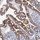 Immunohistochemical staining of human colon shows strong granular cytoplasmic positivity in glandular cells.