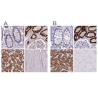 Immunohistochemical staining of human colon, kidney, liver and skeletal muscle using Anti-GLYAT antibody HPA040251 (A) shows similar protein distribution across tissues to independent antibody HPA044094 (B).