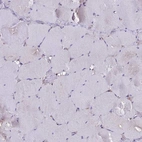 Immunohistochemical staining of human skeletal muscle shows low expression as expected.
