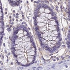 Immunohistochemical staining of human colon using Anti-GLYAT antibody HPA040251.