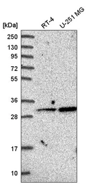 Western blot analysis in human cell line RT-4 and human cell line U-251 MG.