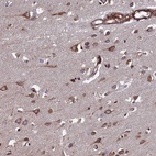 Anti-CTDP1 Antibody