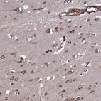 Anti-CTDP1 Antibody