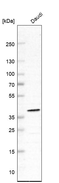 Anti-WDR82 Antibody
