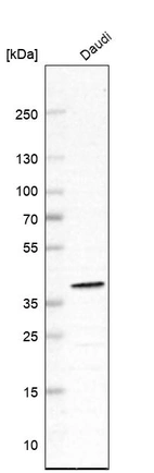 Anti-WDR82 Antibody