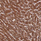 Anti-ST3GAL1 Antibody