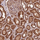 Immunohistochemical staining of human kidney shows strong cytoplasmic positivity in cells in tubules.