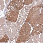 Immunohistochemical staining of human skeletal muscle shows moderate cytoplasmic positivity in myocytes.
