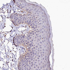 Immunohistochemical staining of human skin shows very weak cytoplasmic positivity in squamous epithelial cells as expected.