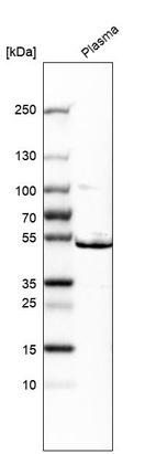 Western blot analysis in human plasma.