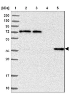 Lane 1: Marker [kDa] 250, 130, 95, 72, 55, 36, 28, 17, 10_br/_Lane 2: Human cell line RT-4_br/_Lane 3: Human cell line U-251MG sp_br/_Lane 4: Human plasma (IgG/HSA depleted)_br/_Lane 5: Human liver tissue
