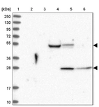 Lane 1: Marker [kDa] 250, 130, 95, 72, 55, 36, 28, 17, 10_br/_Lane 2: Human cell line RT-4_br/_Lane 3: Human cell line U-251 MG_br/_Lane 4: Human plasma_br/_Lane 5: Human Liver tissue_br/_Lane 6: Human Tonsil tissue