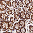 Immunohistochemical staining of human colon shows strong granular cytoplasmic positivity in glandular cells.