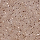 Immunohistochemical staining of human cerebral cortex shows moderate granular cytoplasmic positivity in glial cells.