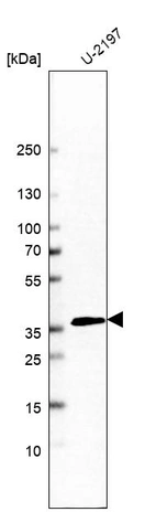 Western blot analysis in human cell line U-2197.