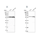 Western blot analysis using Anti-INTS14 antibody HPA040651 (A) shows similar pattern to independent antibody HPA040255 (B).
