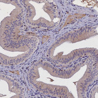 Immunohistochemical staining of human gallbladder shows weak cytoplasmic positivity in glandular cells.