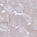 Immunohistochemical staining of human skeletal muscle shows no positivity in myocytes.