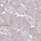 Immunohistochemical staining of human skeletal muscle shows no positivity in myocytes.
