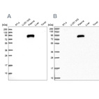 Western blot analysis using Anti-IGFALS antibody HPA040692 (A) shows similar pattern to independent antibody HPA040948 (B).