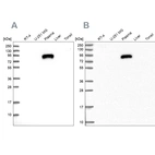 Western blot analysis using Anti-IGFALS antibody HPA040692 (A) shows similar pattern to independent antibody HPA040948 (B).